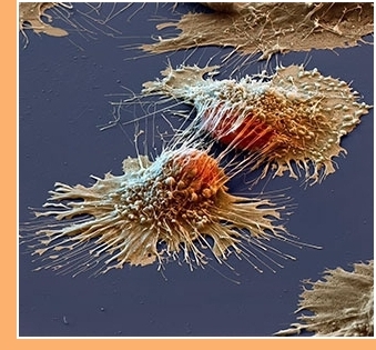 El psicoanálisis ante el enfermo de cáncer imagen El psicoanálisis ante el enfermo de cáncer